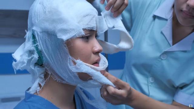 Zahra Kecelakaan dan Dioperasi Plastik, Siapa Pengganti Lea Ciarachel?