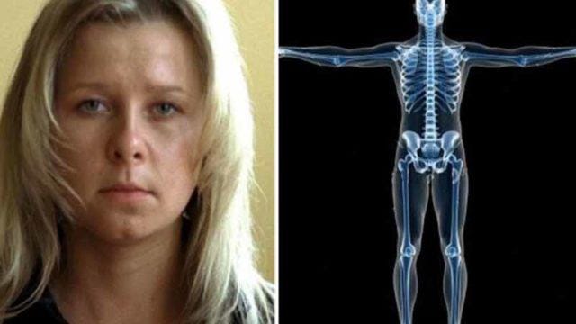 Kayak di Film Superhero, Cewek Ini Punya Penglihatan Tembus Pandang Seperti 'X-Ray'