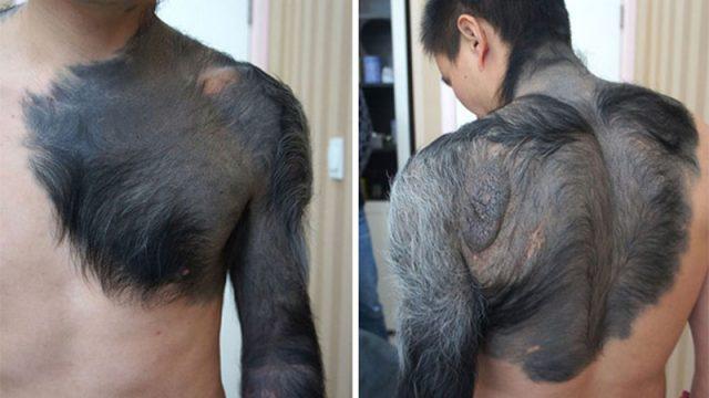 Waw! Orang-orang Ini Memiliki Keunikan karena Kelainan Genetik Mereka