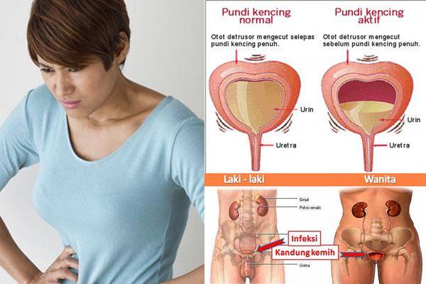 Sumber gambar: tribunnews.com