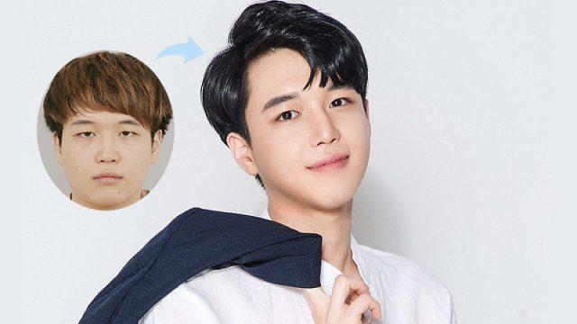 15 Potret Ajaib Cowok Korea Sebelum dan Sesudah Oplas, Bikin Melongo!