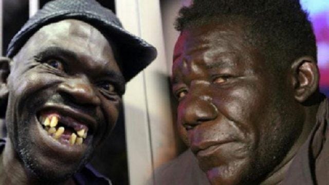 Bukannya Malu, William Malah Bangga Jadi Pria Terjelek di Dunia 4 Kali Berturut-turut!