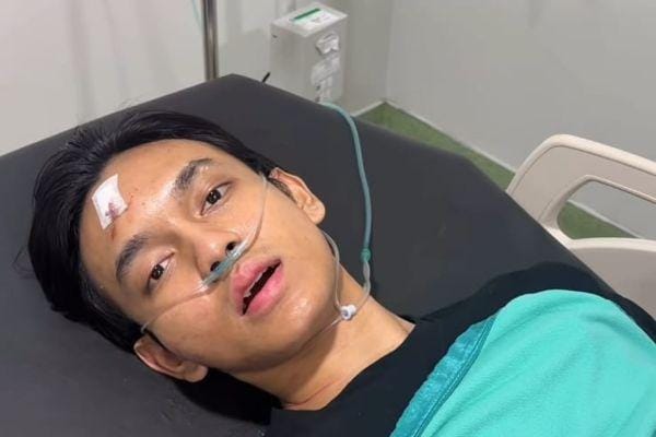 Robby Pantjoro dan Andra ST Alami Kecelakaan Tunggal, Ini Kronologinya